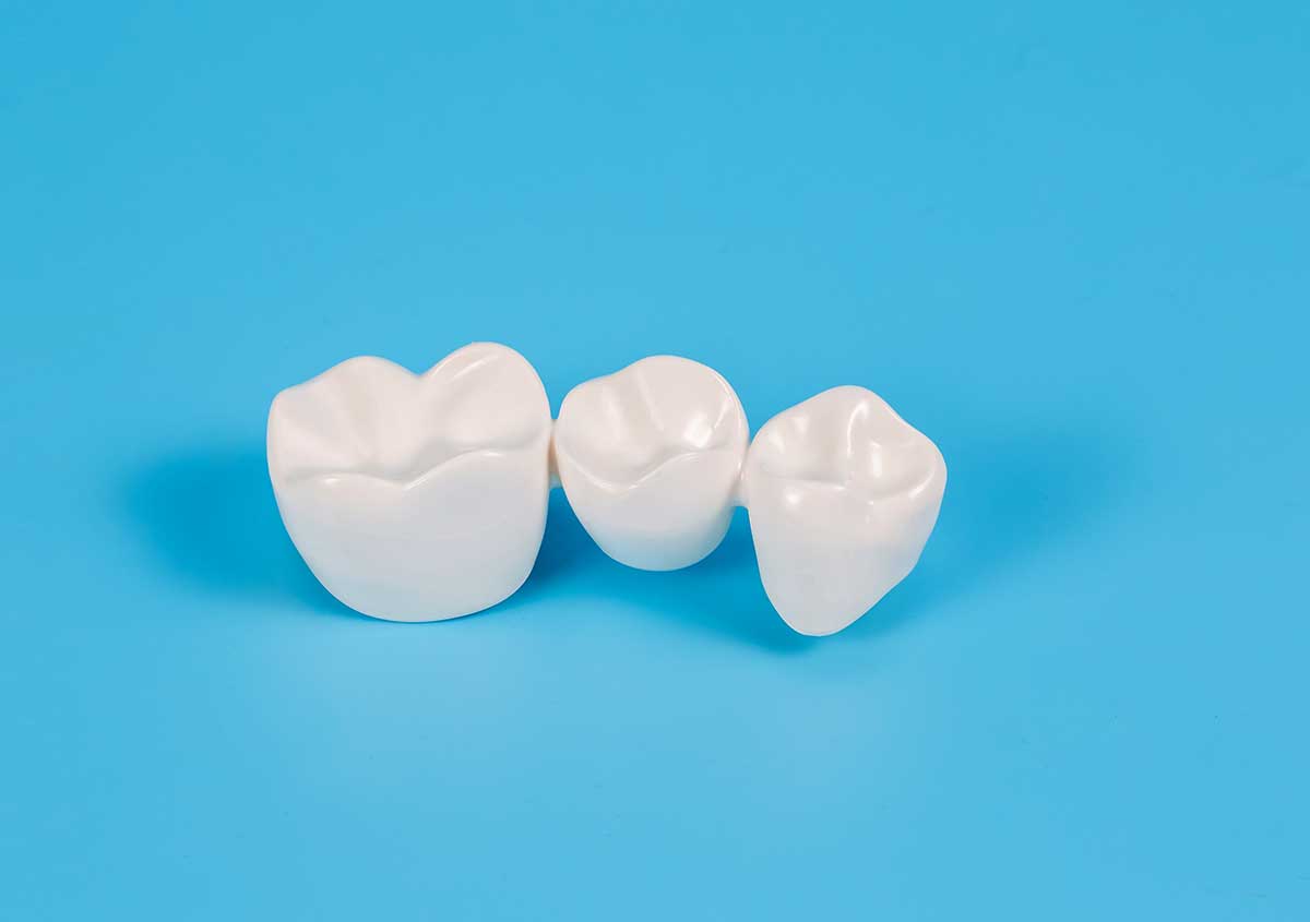 Porcelain Teeth Crowns in Maryville TN Area